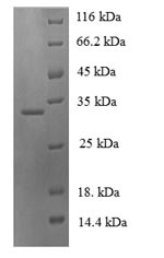 Greater than 90% as determined by SDS-PAGE.Recombinant Human Neuroglobin (NGB) Protein (His-SUMO)