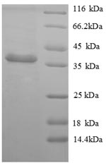 Greater than 90% as determined by SDS-PAGE.