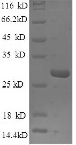 Greater than 90% as determined by SDS-PAGE.Recombinant Mouse Nidogen-1 (NID1) Protein (His)