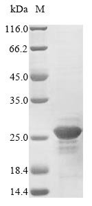Greater than 85% as determined by SDS-PAGE.Recombinant Human Nucleoside Diphosphate Kinase B (NME2) Protein (His&Myc)