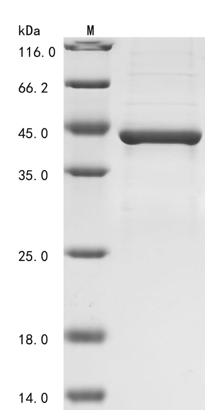Greater than 85% as determined by SDS-PAGE.Recombinant Human Nitric Oxide Synthase, Inducible (NOS2) Protein (GST)