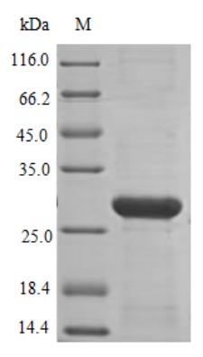 Recombinant Human Nadph Oxidase 4 (NOX4) Protein (His)Recombinant Human Nadph Oxidase 4 (NOX4) Protein (His)