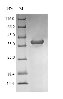 Greater than 90% as determined by SDS-PAGE.Recombinant Rat Nadph Oxidase 4 (NOX4) Protein (His-B2M)