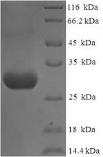 Greater than 90% as determined by SDS-PAGE.Recombinant Human Nephrin (NPHS1) Protein (His)