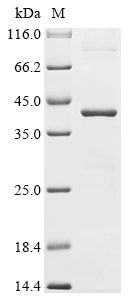 Greater than 90% as determined by SDS-PAGE.Recombinant Human Nucleophosmin (NPM1) Protein (His)