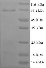Greater than 90% as determined by SDS-PAGE.Recombinant Human Atrial Natriuretic Peptide Receptor 1 (NPR1) Protein (His-SUMO)