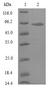 Greater than 90% as determined by SDS-PAGE.Recombinant Rat Atrial Natriuretic Peptide Receptor 3 (NPR3) Protein (His-SUMO)