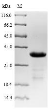 Greater than 85% as determined by SDS-PAGE.Recombinant Mouse Neuropeptide Y Receptor Type 2 (NPY2R) Protein (His-SUMO&Myc)