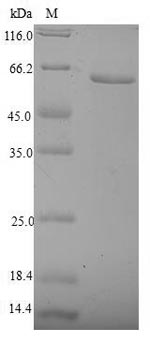 Greater than 90% as determined by SDS-PAGE.Recombinant Human Nuclear Receptor Subfamily 2 Group F Member 6 (NR2F6) Protein (His-SUMO)