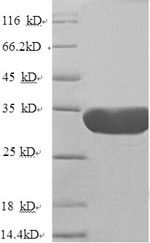 Greater than 90% as determined by SDS-PAGE.Recombinant Human Nuclear Pore Membrane Glycoprotein 210 (NUP210) Protein (His)