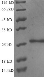 Greater than 90% as determined by SDS-PAGE.Recombinant Human Nuclear Pore Membrane Glycoprotein 210 (NUP210) Protein (His)