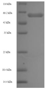 Greater than 90% as determined by SDS-PAGE.Recombinant Human 2-Oxoglutarate Dehydrogenase, Mitochondrial (OGDH) Protein (His-SUMO)