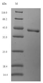 Greater than 90% as determined by SDS-PAGE.Recombinant Human N-Glycosylase/Dna Lyase (OGG1) Protein (His)
