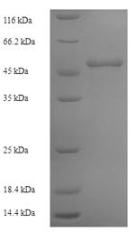 Greater than 90% as determined by SDS-PAGE.Recombinant Human Ornithine Transcarbamylase, Mitochondrial (OTC) Protein (His-SUMO)