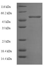 Greater than 90% as determined by SDS-PAGE.Recombinant Mouse Ornithine Transcarbamylase, Mitochondrial (OTC) Protein (His-SUMO)