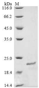 Greater than 90% as determined by SDS-PAGE.Recombinant Mouse Otoraplin (OTOR) Protein (His&Myc)