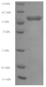Greater than 90% as determined by SDS-PAGE.Recombinant Human Succinyl-Coa:3-Ketoacid-Coenzyme A Transferase 1, Mitochondrial (OXCT1) Protein (His)