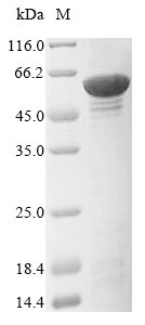 Greater than 85% as determined by SDS-PAGE.Recombinant Human Prolyl 4-Hydroxylase Subunit Alpha-1 (P4HA1) Protein (His)