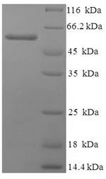 Greater than 90% as determined by SDS-PAGE.Recombinant Human Polyadenylate-Binding Protein 1 (PABPC1) Protein (His-SUMO)