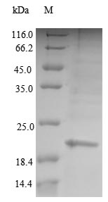 Greater than 90% as determined by SDS-PAGE.Recombinant Human Glycodelin (PAEP) Protein (His)
