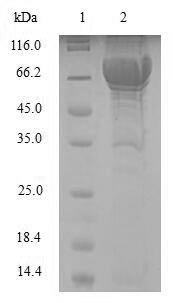 Greater than 90% as determined by SDS-PAGE.Recombinant Human Phenylalanine-4-Hydroxylase (PAH) Protein (His-SUMO)