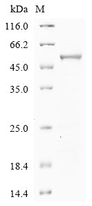 Greater than 85% as determined by SDS-PAGE.Recombinant Human Phenylalanine-4-Hydroxylase (PAH) Protein (His)