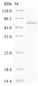 Greater than 90% as determined by SDS-PAGE.Recombinant Mouse Phenylalanine-4-Hydroxylase (PAH) Protein (His)