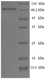 Greater than 90% as determined by SDS-PAGE.Recombinant Human E3 Ubiquitin-Protein Ligase Parkin (PRKN) Protein (His-SUMO)