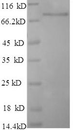 Greater than 90% as determined by SDS-PAGE.