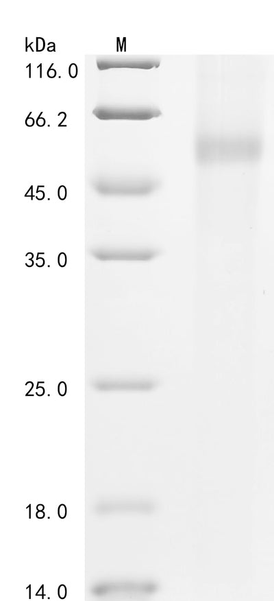 Greater than 85% as determined by SDS-PAGE.Recombinant Human Poly [Adp-Ribose] Polymerase 1 (PARP1) Protein (His-GST)