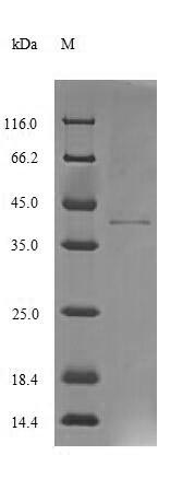 Greater than 85% as determined by SDS-PAGE.Recombinant Human Pterin-4-Alpha-Carbinolamine Dehydratase (PCBD1) Protein (His-GST)