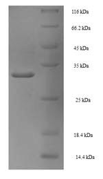 Greater than 90% as determined by SDS-PAGE.Recombinant Human Proliferating Cell Nuclear Antigen (PCNA) Protein (His)