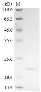 Greater than 90% as determined by SDS-PAGE.Recombinant Human Proprotein Convertase Subtilisin/Kexin Type 6 (PCSK6) Protein (His)