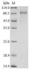 Greater than 85% as determined by SDS-PAGE.Recombinant Human Pyruvate Dehydrogenase E1 Component Subunit Alpha, Somatic Form, Mitochondrial (PDHA1) Protein (His-GST)