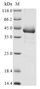 Greater than 90% as determined by SDS-PAGE.Recombinant Human Pyruvate Dehydrogenase E1 Component Subunit Beta, Mitochondrial (PDHB) Protein (His)