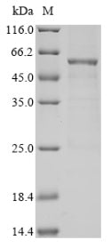 Greater than 85% as determined by SDS-PAGE.Recombinant Human Pyruvate Dehydrogenase Protein X Component, Mitochondrial (PDHX) Protein (His)