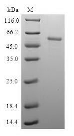 Greater than 90% as determined by SDS-PAGE.Recombinant Human Pyridoxal Kinase (PDXK) Protein (GST)