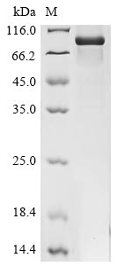Greater than 85% as determined by SDS-PAGE.Recombinant Human Pescadillo Homolog (PES1) Protein (His&Myc)