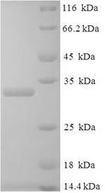 Greater than 90% as determined by SDS-PAGE.Recombinant Human Placenta Growth Factor (PGF) Protein (His-SUMO)