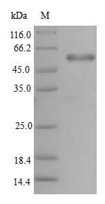 Greater than 90% as determined by SDS-PAGE.Recombinant Human Phd Finger Protein 11 (PHF11) Protein (GST)