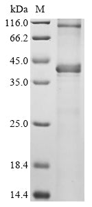 Greater than 85% as determined by SDS-PAGE.Recombinant Human Phd Finger Protein 6 (PHF6) Protein (His)