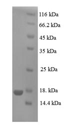 Greater than 90% as determined by SDS-PAGE.Recombinant Human Prolactin-Inducible Protein (PIP) Protein (His)