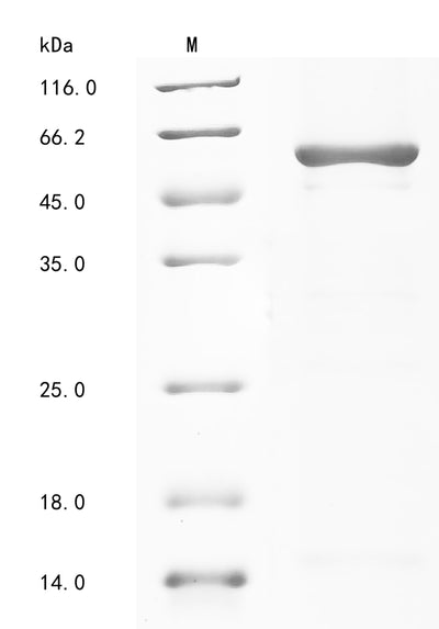 Greater than 85% as determined by SDS-PAGE.Recombinant Human Pyruvate Kinase Pkm (PKM) Protein (GST)