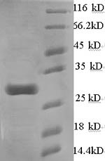 Greater than 90% as determined by SDS-PAGE.Recombinant Mouse Calcium-Dependent Phospholipase A2 (PLA2G5) Protein (His-SUMO)