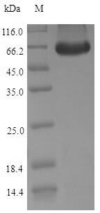 Greater than 90% as determined by SDS-PAGE.Recombinant Dog Inactive Pancreatic Lipase-Related Protein 1 (PNLIPRP1) Protein (His-SUMO)
