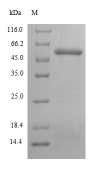 Greater than 85% as determined by SDS-PAGE.Recombinant Human Paraneoplastic Antigen Ma2 (PNMA2) Protein (His-SUMO)