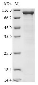 Greater than 85% as determined by SDS-PAGE.Recombinant Human Dna Polymerase Theta (POLQ) Protein (His&Myc)