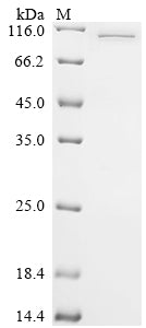 Greater than 85% as determined by SDS-PAGE.Recombinant Human Dna Polymerase Theta (POLQ) Protein (His-SUMO)