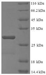 Greater than 90% as determined by SDS-PAGE.