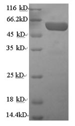 Greater than 90% as determined by SDS-PAGE.Recombinant Human Serum Paraoxonase/Arylesterase 1 (PON1) Protein (GST)
